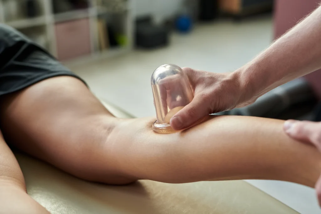 cupping therapy on leg for wellness indoors 2026 03 24 06 11 24 utc